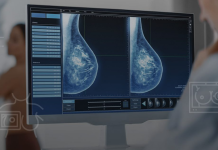 “Más de mil mujeres esperan una mamografía”: la Plataforma del Área III de Salud de la Región de Murcia exige la dimisión del consejero Pedreño por su nefasta gestión sanitaria Un profesional realiza una mamografía | La Protesta Diario