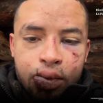 Mercenario colombiano denuncia secuestro y agresión por el Ejército ucraniano tras cumplir contrato El mercenario colombiano en su video difundido en redes sociales | Camilo Melo - Fb