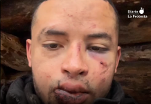 Mercenario colombiano denuncia secuestro y agresión por el Ejército ucraniano tras cumplir contrato El mercenario colombiano en su video difundido en redes sociales | Camilo Melo - Fb