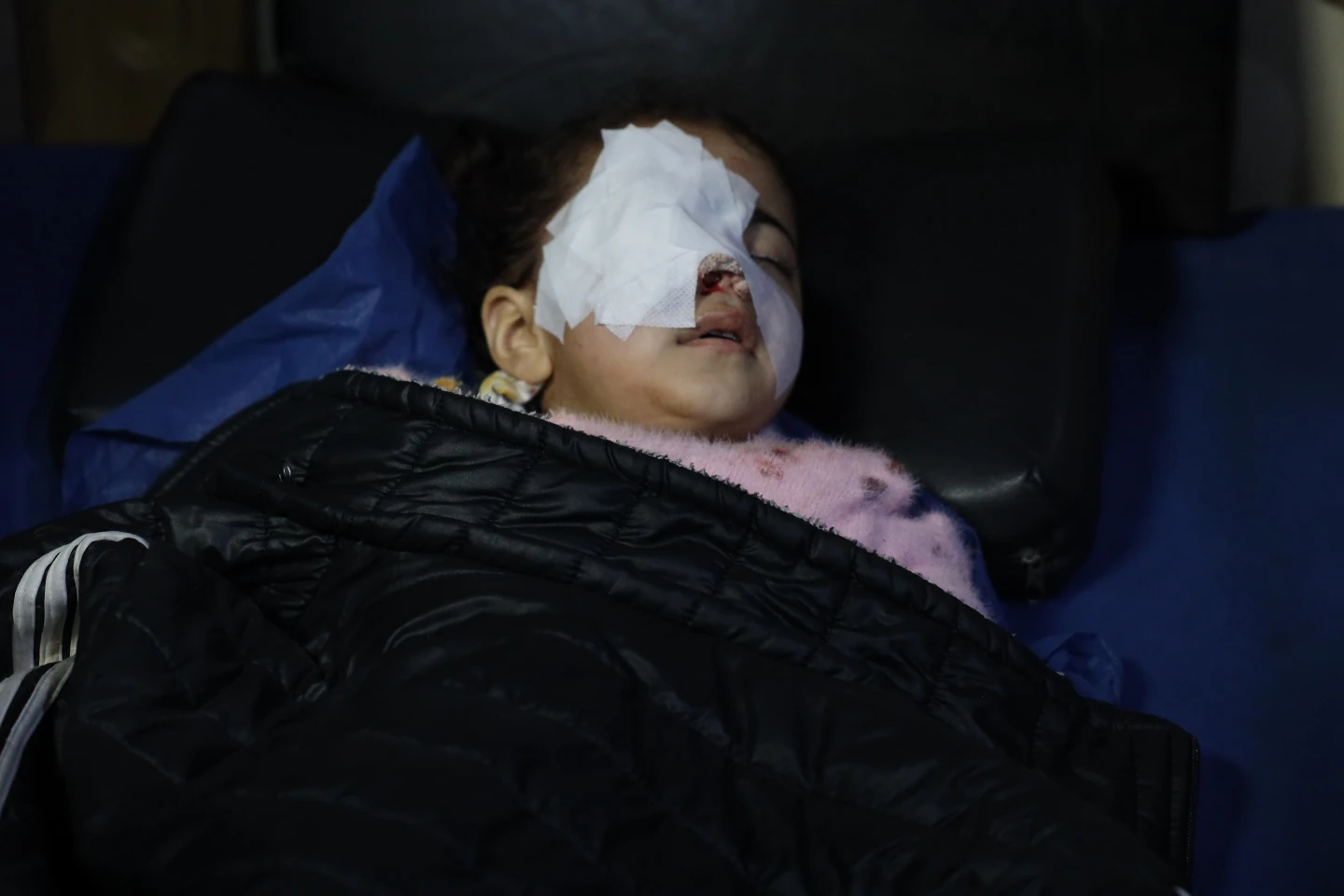 La niña siria Fatima al-Zahra Abu Sheikh, de 4 años, yace en una cama de hospital después de ser herida cuando estallaron enfrentamientos entre las fuerzas del gobierno sirio y combatientes kurdos en una zona en disputa de la ciudad norteña de Alepo, Siria, el martes 6 de enero de 2026. (Foto AP/Omar Albam)