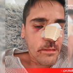 Imagen difundida por Fonsi Loaiza en sus redes sociales después de denunciar la agresión de la que fue víctima en Cádiz.