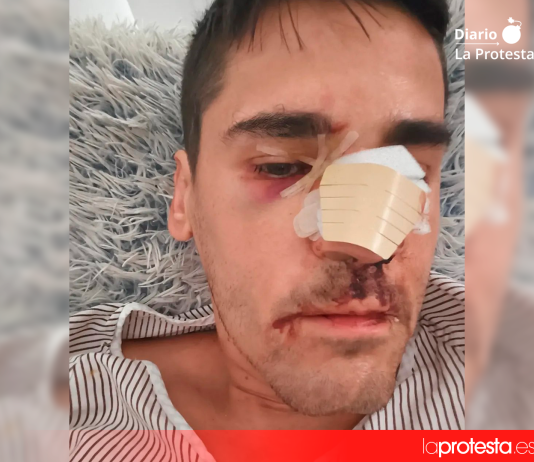 Imagen difundida por Fonsi Loaiza en sus redes sociales después de denunciar la agresión de la que fue víctima en Cádiz.
