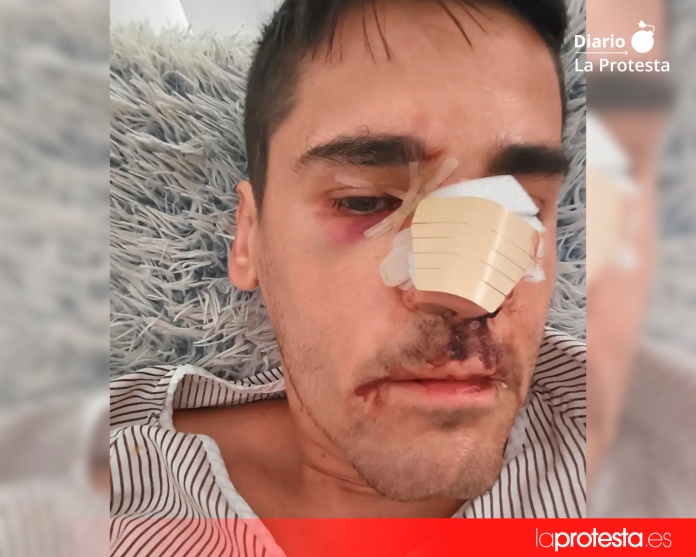 Imagen difundida por Fonsi Loaiza en sus redes sociales después de denunciar la agresión de la que fue víctima en Cádiz.