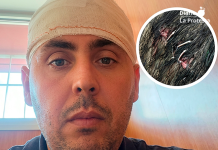 El agredido, con vendajes en la cabeza, y detalle de la herida sufrida. (Cedida)