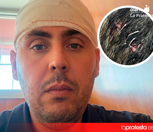 El agredido, con vendajes en la cabeza, y detalle de la herida sufrida. (Cedida)